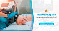 Neurosonografia — ecografia cerebrală la nou-născuți