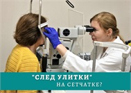 «След улитки» на сетчатке?